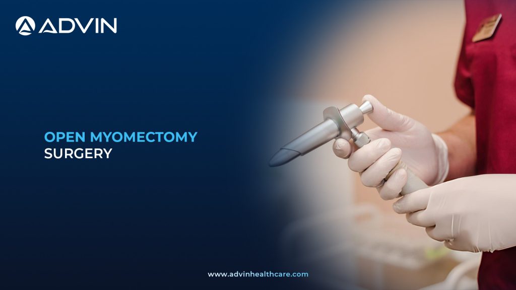 Open Myomectomy Surgery – Safe and Effective Treatment for Multiple Uterine Fibroids