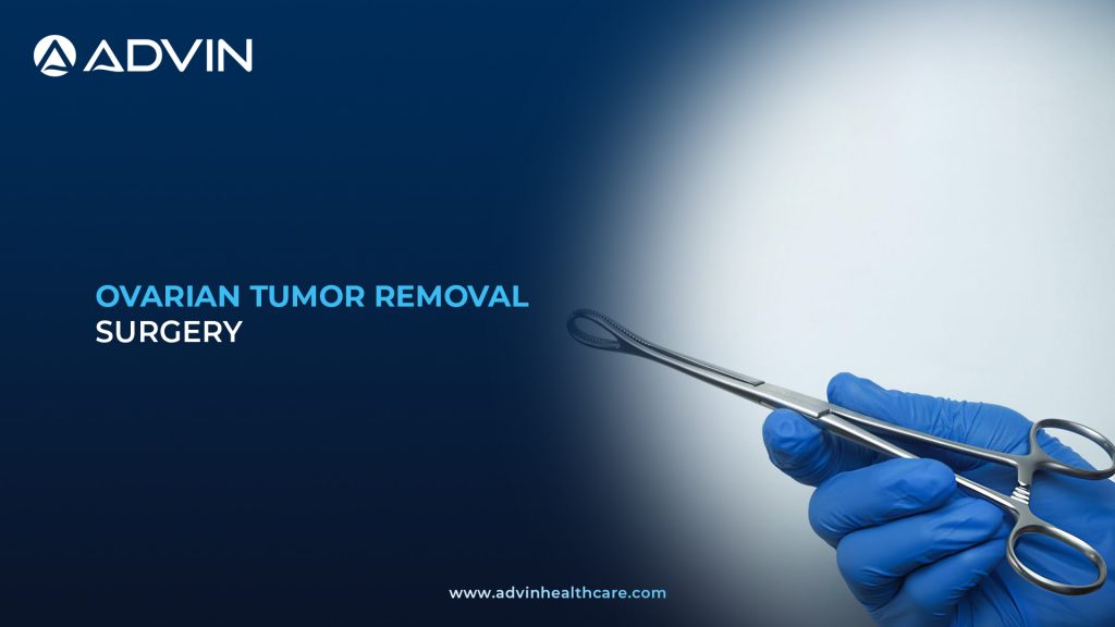 Ovarian Tumor Removal Surgery – Laparoscopic and Open Ovarian Tumor Resection Procedure