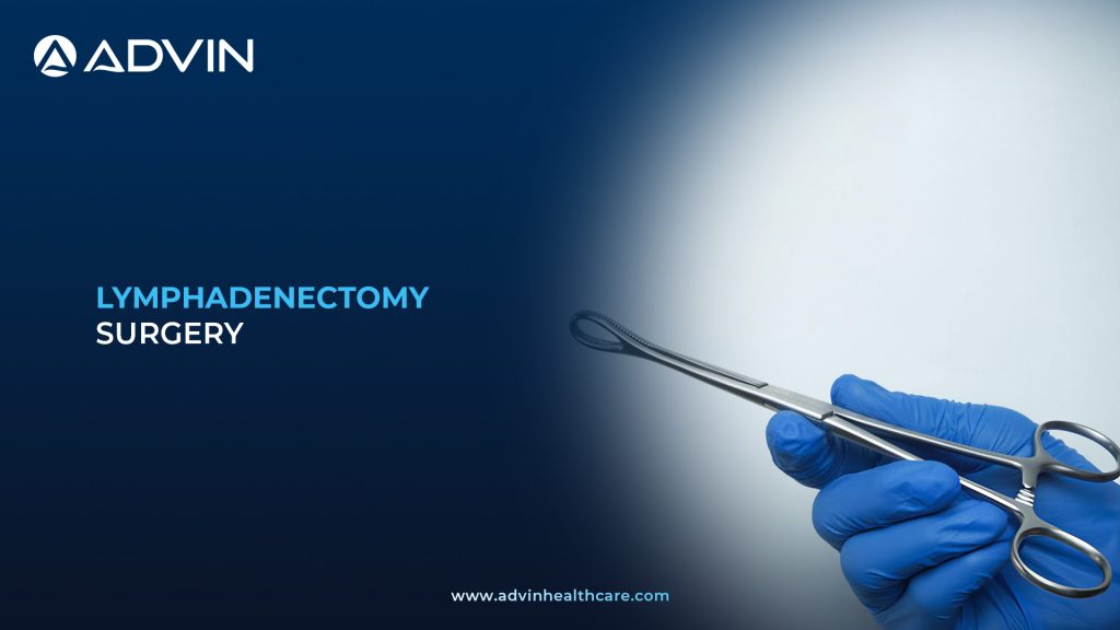 Lymphadenectomy Surgery – Accurate Tumor Spread Assessment and Node Clearance Method