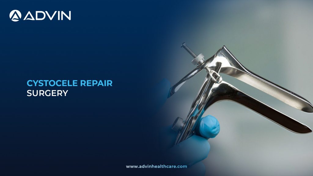 Cystocele Repair Surgery – Advanced Bladder Prolapse Correction Procedure