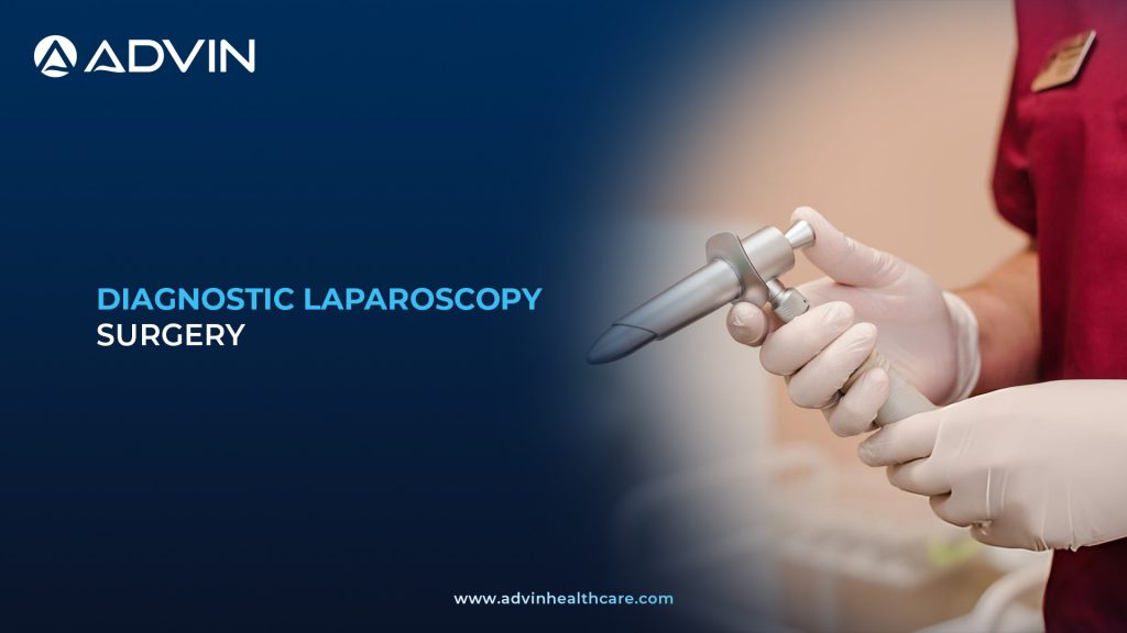 Diagnostic Laparoscopy Surgery – Modern Endoscopic Technique for Abdominal Diagnosis