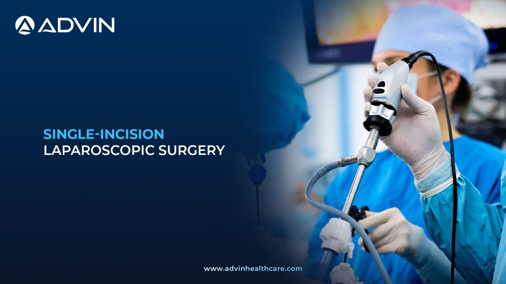 Single-Incision Laparoscopic Surgery – Innovative Minimally Invasive Method for Faster Recovery