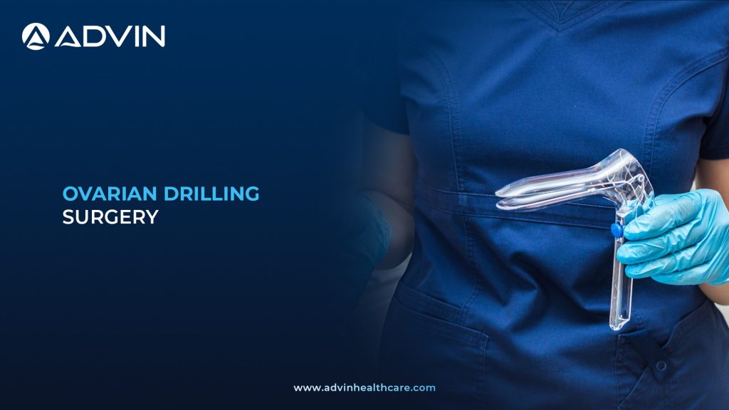 Ovarian Drilling Surgery – Effective Surgical Solution for Ovulation Induction