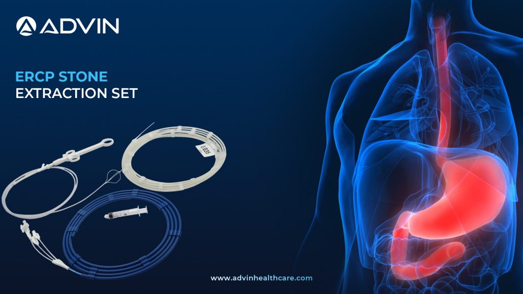 ERCP Stone Extraction Set – Complete Solution for Safe and Efficient CBD Stone Removal