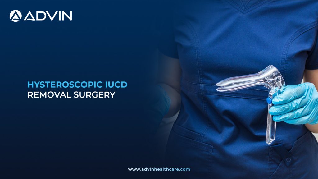 Hysteroscopic Foreign Body Removal Surgery – Safe and Efficient Uterine Cavity Cleaning Method